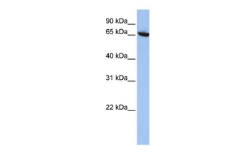 CBFA2T2 Rabbit Polyclonal Antibody