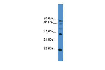 ASCL2 Rabbit Polyclonal Antibody