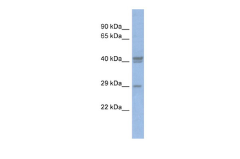 CEBPD Rabbit Polyclonal Antibody