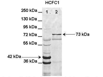 HCFC1 Rabbit Polyclonal Antibody