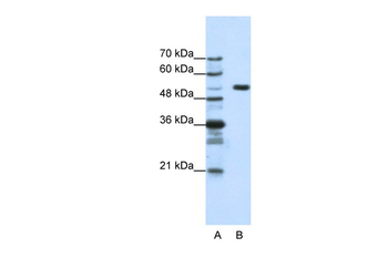 HCFC1 Rabbit Polyclonal Antibody