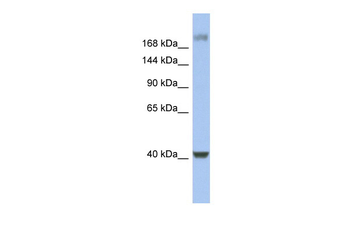 HCFC1 Rabbit Polyclonal Antibody