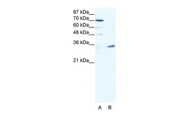 MAGEA9 Rabbit Polyclonal Antibody