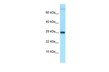 Lmo2 Rabbit Polyclonal Antibody