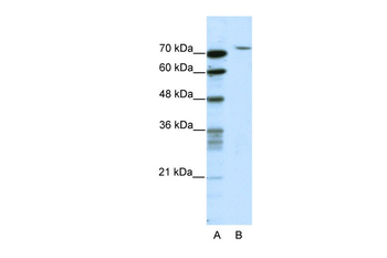 TAF6 Rabbit Polyclonal Antibody