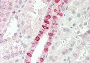 RBM5 Rabbit Polyclonal Antibody