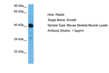 SMAD1 Rabbit Polyclonal Antibody