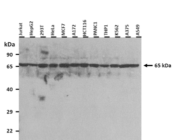 SMAD1 Rabbit Polyclonal Antibody