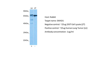 SMAD1 Rabbit Polyclonal Antibody