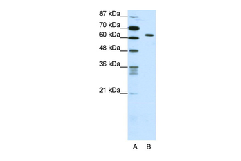 SMAD1 Rabbit Polyclonal Antibody