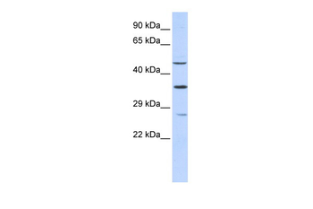 MEF2B Rabbit Polyclonal Antibody