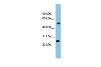 MEF2D Rabbit Polyclonal Antibody