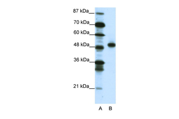 MEOX2 Rabbit Polyclonal Antibody