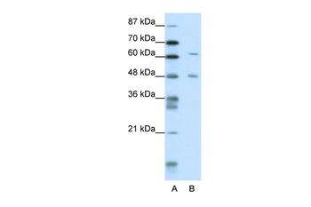 NAB2 Rabbit Polyclonal Antibody
