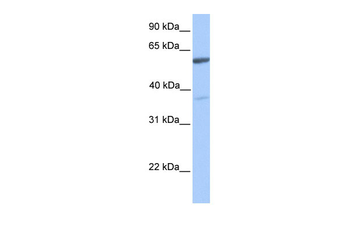 NAB2 Rabbit Polyclonal Antibody