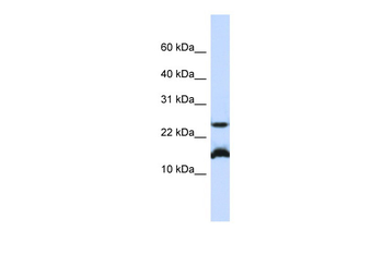 BATF Rabbit Polyclonal Antibody