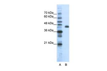 ZFP36L2 Rabbit Polyclonal Antibody