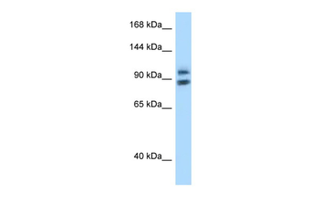 ZHX1 Rabbit Polyclonal Antibody