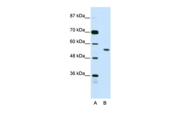 BRD3 Rabbit Polyclonal Antibody