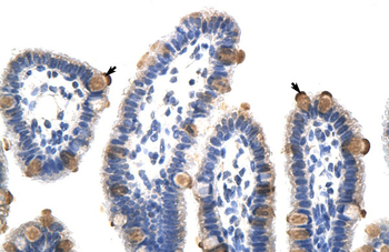 GTF3C5 Rabbit Polyclonal Antibody