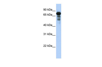 TRIM29 Rabbit Polyclonal Antibody
