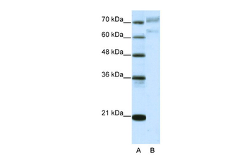 AATF Rabbit Polyclonal Antibody