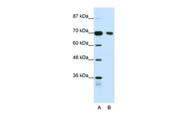 TRIM32 Rabbit Polyclonal Antibody