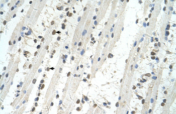 TRIM32 Rabbit Polyclonal Antibody