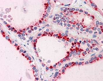 RYBP Rabbit Polyclonal Antibody