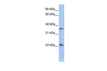 RYBP Rabbit Polyclonal Antibody