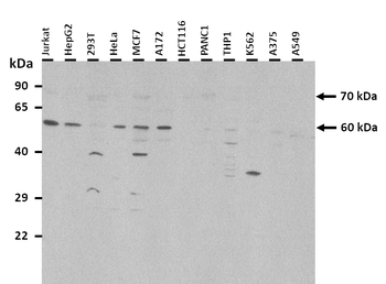 KEAP1 Rabbit Polyclonal Antibody