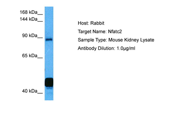 NFATC2 Rabbit Polyclonal Antibody