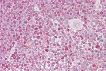 NFATC2 Rabbit Polyclonal Antibody