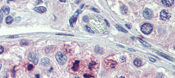 STAT5B Rabbit Polyclonal Antibody