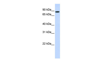 STAT5B Rabbit Polyclonal Antibody