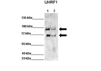 UHRF1 Rabbit Polyclonal Antibody