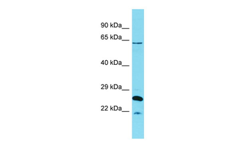 HCFC1 Rabbit Polyclonal Antibody