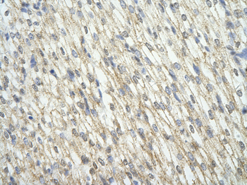 CNOT7 Rabbit Polyclonal Antibody