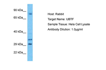 UBTF Rabbit Polyclonal Antibody