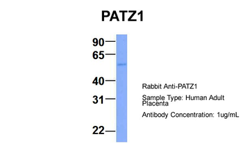 PATZ1 Rabbit Polyclonal Antibody