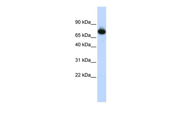 PATZ1 Rabbit Polyclonal Antibody