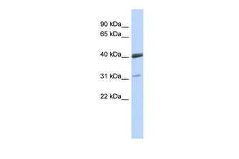 VSX1 Rabbit Polyclonal Antibody