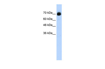 CXXC1 Rabbit Polyclonal Antibody