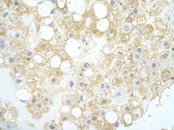 NT5C Rabbit Polyclonal Antibody