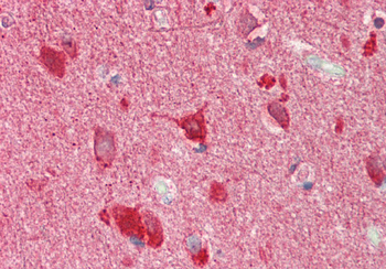 TSC22D2 Rabbit Polyclonal Antibody