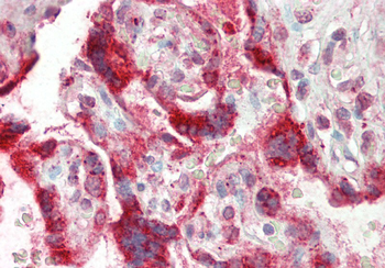 TSC22D2 Rabbit Polyclonal Antibody
