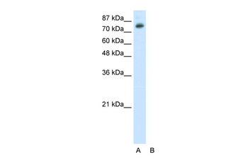 TSC22D2 Rabbit Polyclonal Antibody