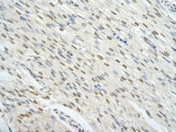 FOXJ3 Rabbit Polyclonal Antibody