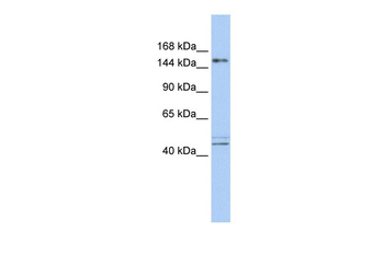 ADNP Rabbit Polyclonal Antibody
