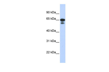 MIZF Rabbit Polyclonal Antibody